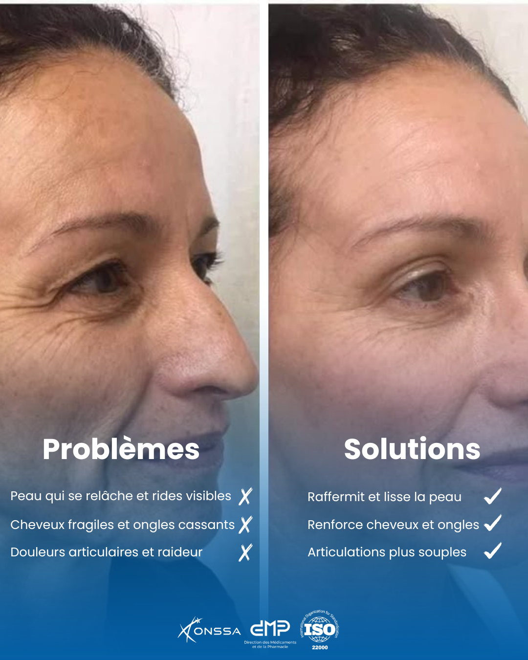 Collagène Marin Pur – 30 Gélules